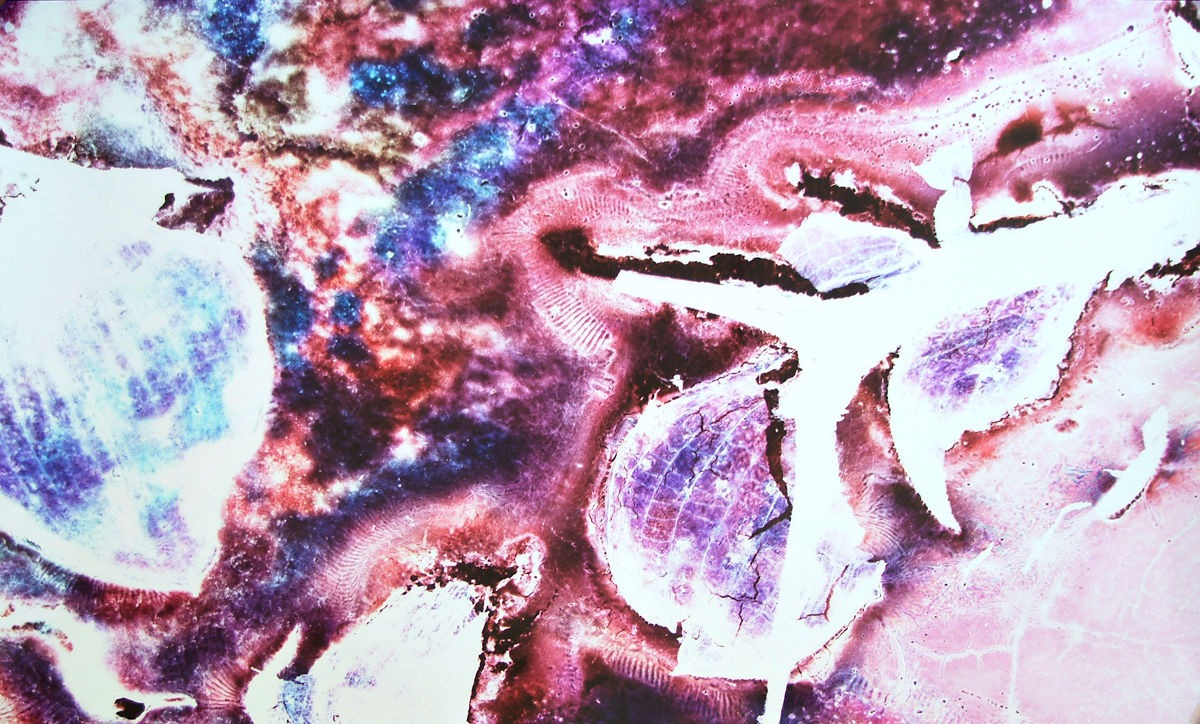 Nebulosity