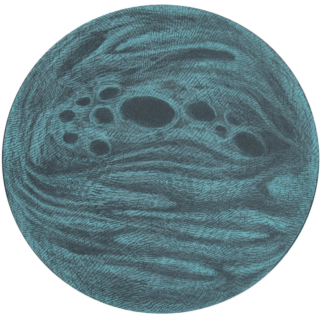 Calcification 1 view 2