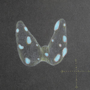 Abnormal Butterfly by Kareen Adam